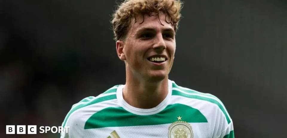 Futbolchi Celtik formasida kulgili yuz bilan